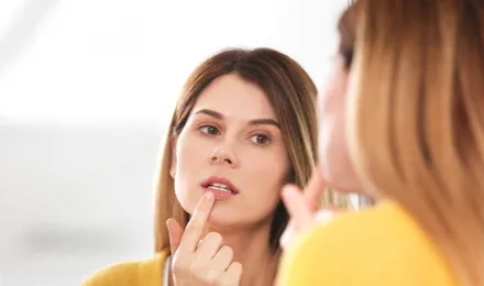 Eine Frau behandelt einen Lippenherpes vor einem Spiegel