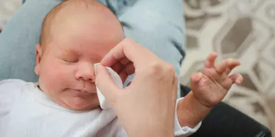 Ein Elternteil reinigt die verklepten Augen eines Babys